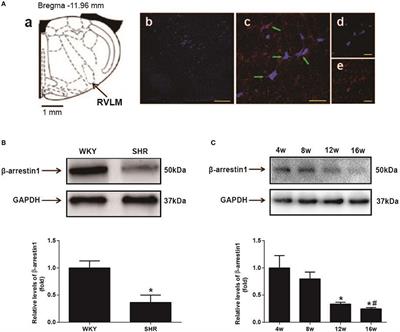 Overexpression of ß-Arrestin1 in the Rostral Ventrolateral Medulla Downregulates Angiotensin Receptor and Lowers Blood Pressure in Hypertension